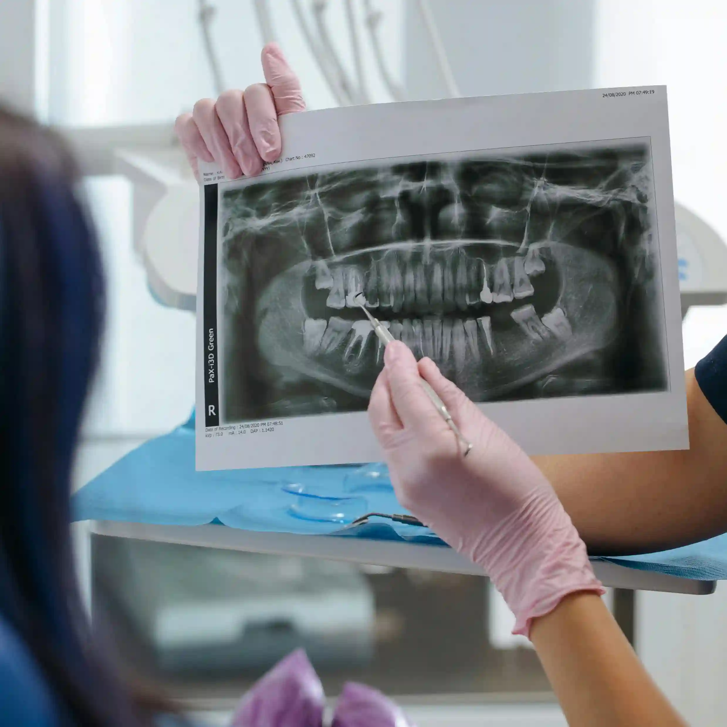 Endodoncia